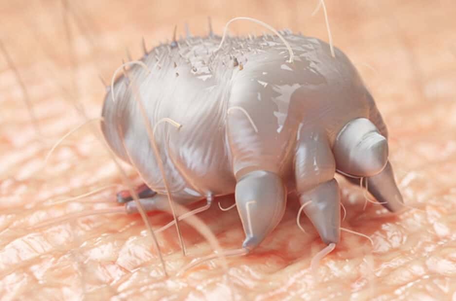 옴 증상 및 원인과 치료법 : 옴진드기 2 사람 피부에 달라 붙어 있는 옴을 현미경으로 확대한 모습