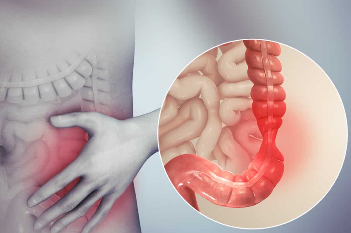 변이 가늘어요 : 가는변, 얇은변 원인 5가지 정리 1 좌측 하복부를 만지고 있는 사람